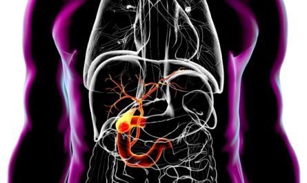 علائم پوستی سنگ صفرا و التهاب کیسه صفرا؛ از زردی تا خارش شدید