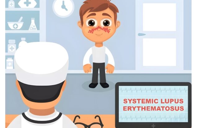 لوپوس در کودکان؛ علائم، خطرات و راهکارهای درمانی