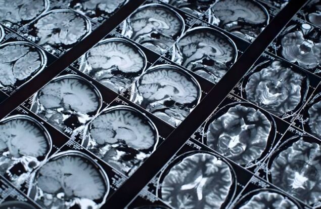 کشف پروتئین DMTF1 برای بازسازی سلول های عصبی و معکوس سازی پیری مغز