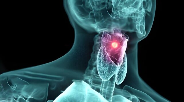 گرفتگی صدا را جدی بگیرید: نشانه هشدار دهنده سرطان حنجره