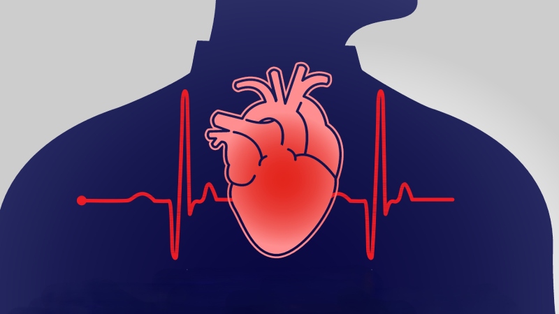 فیبریلاسیون دهلیزی چیست و چه خطراتی دارد؟