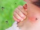 چرا پشه ها بعضی افراد را بیشتر نیش می زنند؟ راز بوی پوست، ژنتیک و گروه خونی