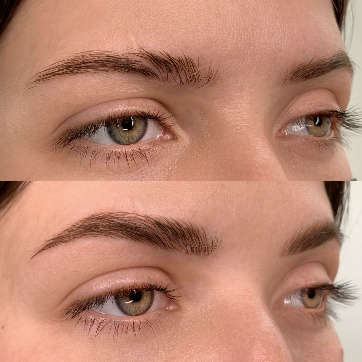افراد دارای جای زخم روی ابرو